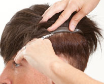 CS system as an alternative to a toupee